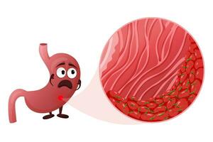 dibujos animados estómago personaje con helicobacter pylori infección en mucosa capa debajo aumento vector