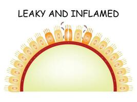 Leaky and Inflamed Science Design Vector Illustration