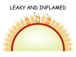 Leaky and Inflamed Science Design Vector Illustration