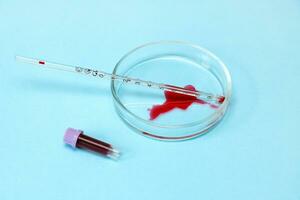 Petri dish with blood stain in the form of a heart, test tube, with blood photo