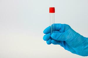 a hand in a medical glove holds an empty test tube on a light background with copy space photo