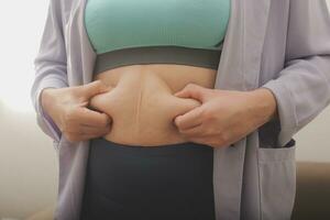 A woman shows an inflated thick belly, the concept of excess weight and weight loss photo