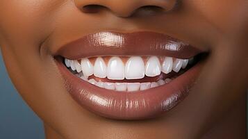 Close-up of smiling woman with healthy teeth. Teeth whitening concept AI Generated photo