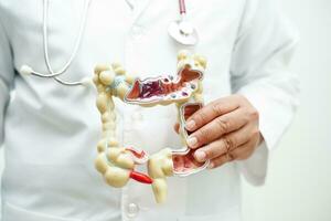 Intestine, doctor holding anatomy model for study diagnosis and treatment in hospital. photo