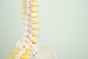 Spinal nerve and bone, Lumbar spine displaced herniated disc fragment, Model for treatment medical in the orthopedic department. photo