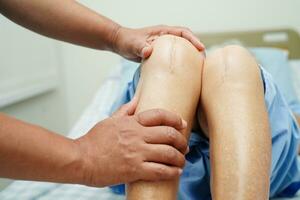 Doctor checking Asian elderly woman patient with scar knee replacement surgery in hospital. photo