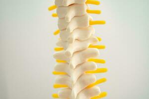 Lumbar spine displaced herniated disc fragment, spinal nerve and bone. Model for treatment medical in the orthopedic department. photo