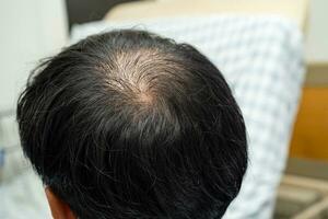 calvo en la cabeza media y sin pérdida de cabello glabro de hombre de oficina activo inteligente de negocios asiáticos maduros. foto