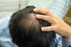 calvo en la cabeza media y sin pérdida de cabello glabro de hombre de oficina activo inteligente de negocios asiáticos maduros. foto