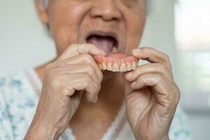 Asian elderly woman patient holding to use denture, healthy strong medical concept. photo