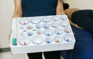 Physiotherapist hands holding cupping cups, Hands holding cupping box for physiotherapy, Cupping kit for physiotherapy photo