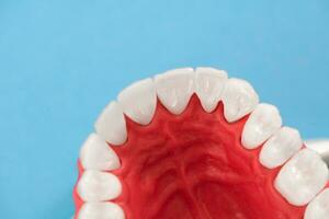 Teeth implant and crown installation process parts isolated on a blue background. Medically accurate 3D model. photo