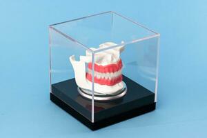 Human jaw with teeth implants anatomy model isolated on blue background in a glass box. photo