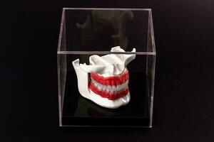 Human jaw with teeth implants anatomy model isolated on black background in a glass box. photo