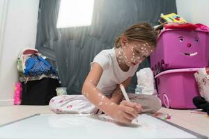 Little school girl with chickenpox drawing on white board in kids' room, antiseptic cream applied to face and body. Chalkboard and toys background. photo