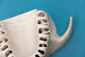 Superior humano mandíbula sin dientes modelo médico implante aislado en azul antecedentes. sano dientes, dental cuidado y ortodoncia concepto. foto