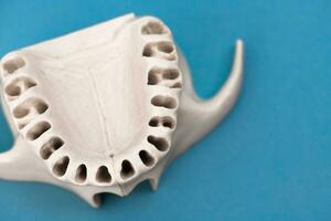 Superior humano mandíbula sin dientes modelo médico implante aislado en azul antecedentes. sano dientes, dental cuidado y ortodoncia concepto. foto