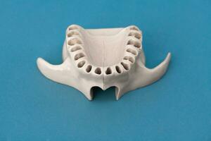 Upper human jaw without teeth model medical implant isolated on blue background. Healthy teeth, dental care and orthodontic concept. photo