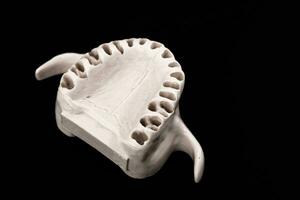 Superior humano mandíbula sin dientes modelo médico implante aislado en negro antecedentes. sano dientes, dental cuidado y ortodoncia concepto. foto