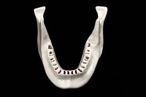 Upper human jaw without teeth model medical implant isolated on black background. Healthy teeth, dental care and orthodontic concept. photo