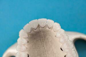 Superior humano mandíbula con dientes anatomía modelo aislado en azul antecedentes. sano dientes, dental cuidado y ortodoncia médico concepto. foto