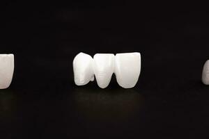 dientes implante y corona instalación proceso partes aislado en un negro antecedentes. médicamente preciso 3d modelo. foto
