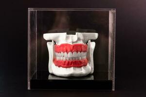 Human jaw with teeth implants anatomy model isolated on black background in a glass box. photo