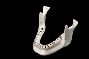 Superior humano mandíbula sin dientes modelo médico implante aislado en negro antecedentes. sano dientes, dental cuidado y ortodoncia concepto. foto
