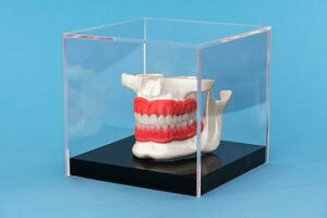 humano mandíbula con dientes implantes anatomía modelo aislado en azul antecedentes en un vaso caja. foto