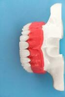 Teeth implant and crown installation process parts isolated on a blue background. Medically accurate 3D model. photo