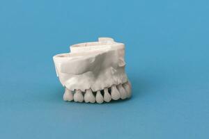 Superior humano mandíbula con dientes anatomía modelo aislado en azul antecedentes. sano dientes, dental cuidado y ortodoncia médico concepto. foto