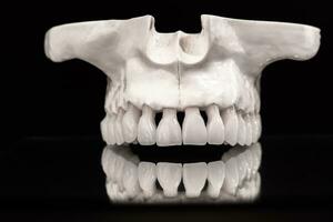Superior humano mandíbula con un reflexión en el vaso anatomía modelo solado en azul antecedentes. sano dientes, dental cuidado y ortodoncia médico concepto. foto
