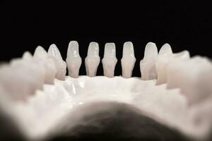 inferior humano mandíbula con dientes anatomía modelo aislado en negro antecedentes. sano dientes, dental cuidado y ortodoncia médico cuidado de la salud concepto. foto