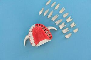 Teeth implant and crown installation process parts isolated on a blue background. Medically accurate 3D model. photo