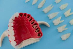 Teeth implant and crown installation process parts isolated on a blue background. Medically accurate 3D model. photo