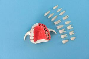 Teeth implant and crown installation process parts isolated on a blue background. Medically accurate 3D model. photo