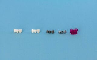 Teeth implant and crown installation process parts isolated on a blue background. Medically accurate 3D model. photo