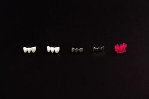 Teeth implant and crown installation process parts isolated on a black background. Medically accurate 3D model. photo