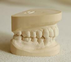 Dental gypsum model mould of teeth photo
