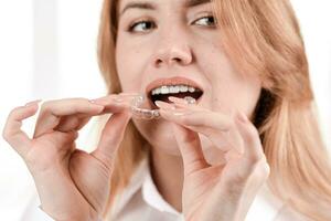 Dental care.Smiling girl with braces on her teeth holds aligners in her hands and shows the difference between them photo