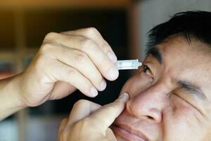 Asian man uses artificial tear lubricant eye drops with his eyes. Concept, Healthcare. Treatment for dry eye symptoms, eye inflammation diseases. Relief irritated optics. photo