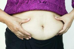 Closeup woman hands touch big belly, fat with cellulite abdomen. Concept, obesity. Overweight. Body shape problem for woman after pregnancy or getting older. Heath care. photo