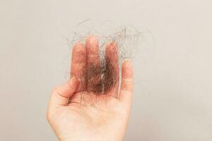 close up photo of female hand holding lost hair in hand on a beige background.