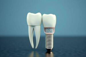 Close up of a dental tooth implant or healthy human teeth. White enamel and dental implants surgery concept by AI Generated photo