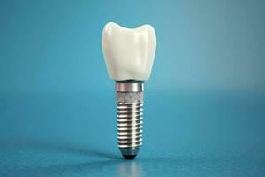 Close up of a dental tooth implant or healthy human teeth. White enamel and dental implants surgery concept by AI Generated photo