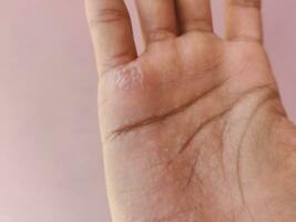 Wrinkly Hands After Swimming. Fingers get so wrinkly after bathing photo