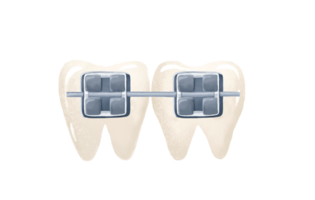 White teeth and metal braces. Orthodontic treatment. Baby cute isolated illustration on  transparent background. png