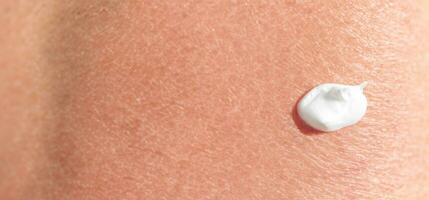 AI Generative Close up of Sunscreen Protection or Sun Cream on human skin. photo