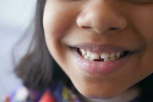 detalle Disparo de niño con dientes desaparecido foto