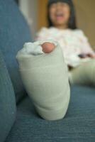 little child with plaster bandage on leg. photo